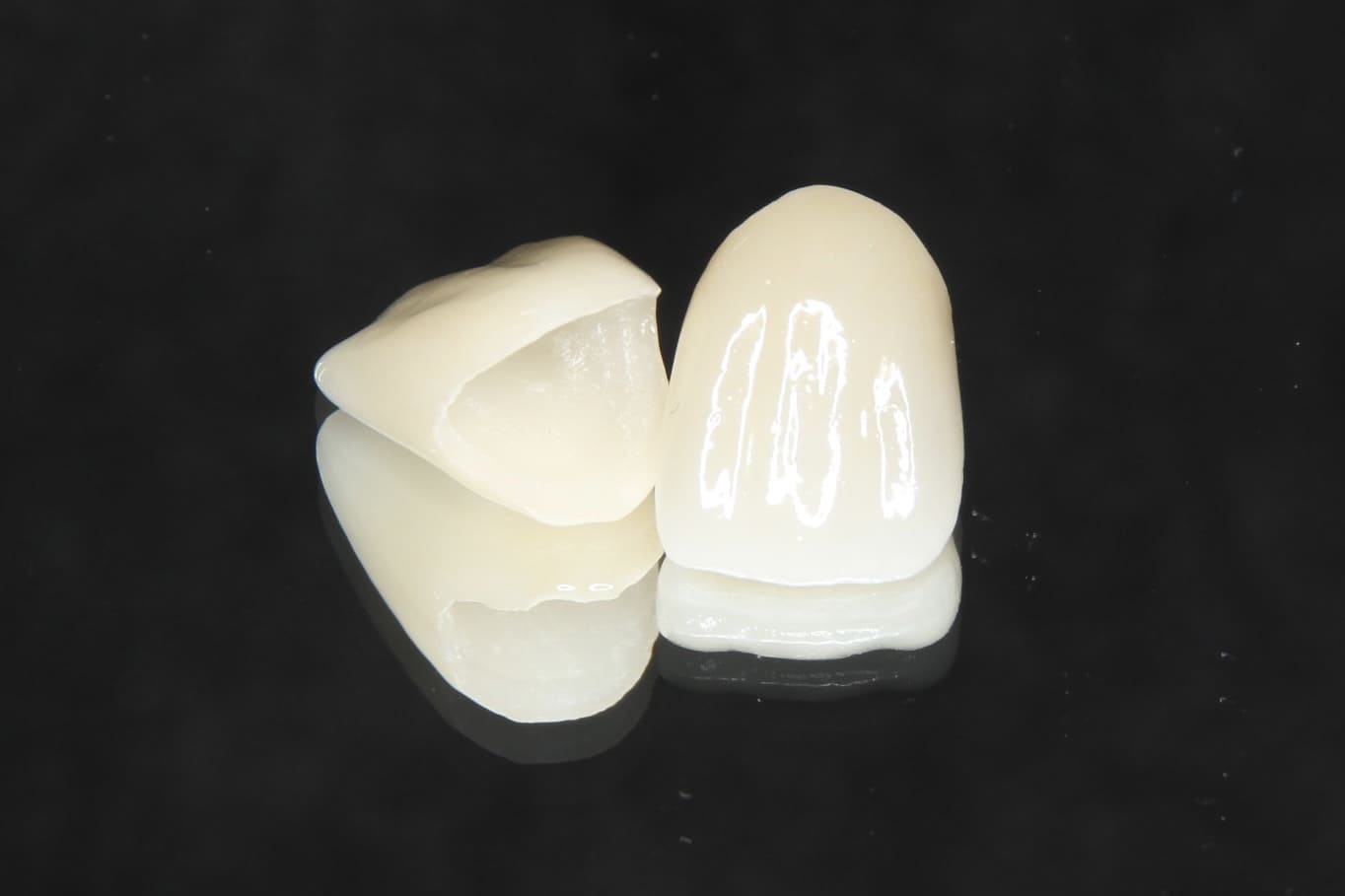 ハイブリッドセラミック・セラミックインレー